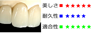 オールセラミックス(e-max)