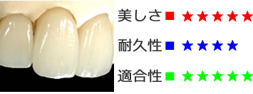 オールセラミックス（e-max）