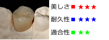 CAD冠(臼歯部のみ)