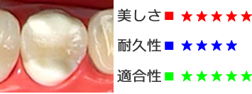 オールセラミックス(e-max)
